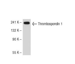 Thrombospondin 1 Antibody (SPM321) - Western Blotting - Image 50644 