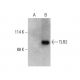 TLR2 Antibody (A-9) - Western Blotting - Image 387957