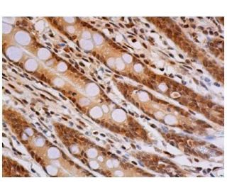 Ubiquitin Antibody (P4D1) - Immunohistochemistry - Image 356766 