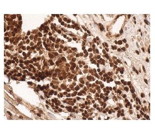 Ubiquitin Antibody (P4G7) - Immunohistochemistry - Image 156790 