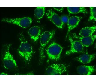 FAM109B (D-2): sc-377483. Immunofluorescence staining of formalin-fixed HeLa cells showing cytoplasmic vesicles localizati 