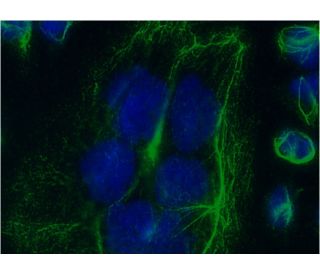 P2X5 (H-5): sc-365036. Immunofluorescence staining of methanol-fixed HeLa cells showing membrane localization. Note DAPI n 