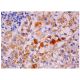 VCAM-1 Antibody (M/K-2) - Immunohistochemistry - Image 284874 