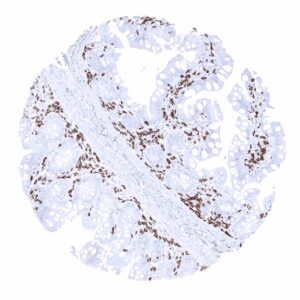 Ileum, mucosa - In the ileum mucosa, CD3 positive T-lymphocytes are usually numerous