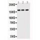 ABCB11 Antibody