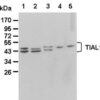 Anti-TIAL1 pAb IP