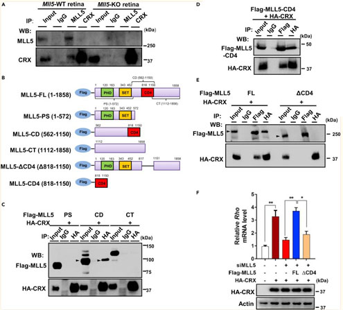 Immunoprecipitation using TrueBlot Anti-Rabbit IgG