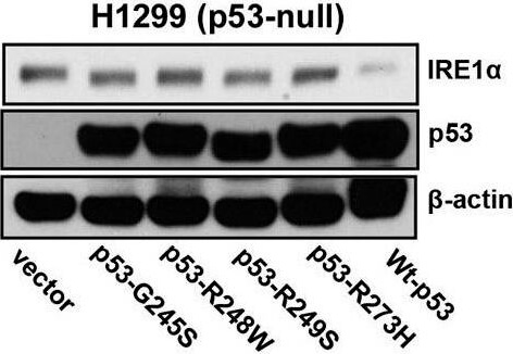 Western Blot using Mouse TrueBlot® ULTRA: Anti-Mouse Ig HRP