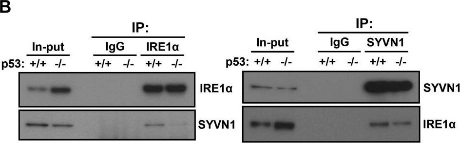 Western Blot using Mouse TrueBlot® ULTRA: Anti-Mouse Ig HRP