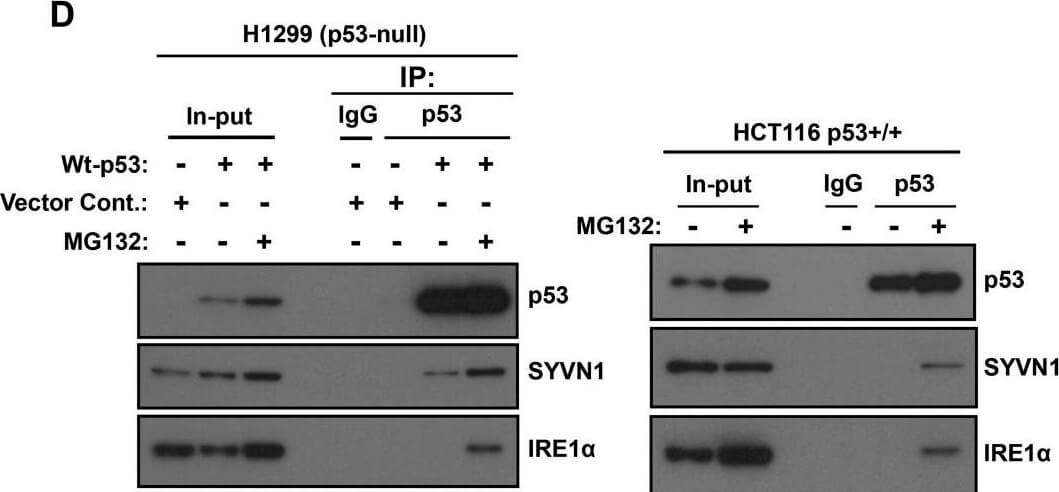 Western Blot using Mouse TrueBlot® ULTRA: Anti-Mouse Ig HRP