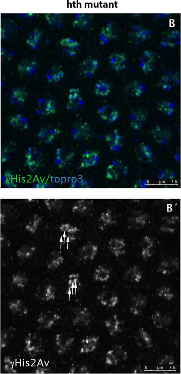 Immunohistochemistry of Anti-Histone H2AvD pS137