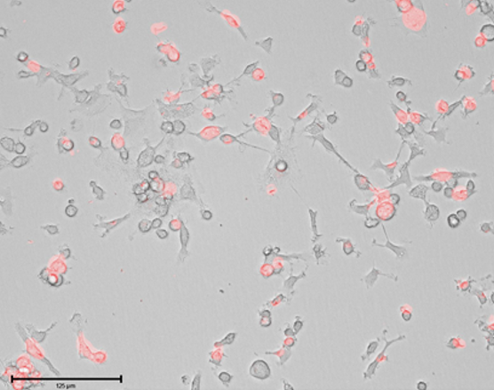 Microglia Phagocytosis.png