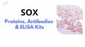 Impulsionar a investigação de doenças com proteínas SOX, anticorpos e kits ELISA