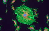 Sonde MYB pour l'HIS CE/IVD - Leucémie lymphoïde chronique (CLL)