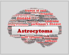 Astrocytome