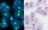 Sondes centromériques pour l'hybridation in situ CE/IVD - Génétique moléculaire - Dénombrement des chromosomes